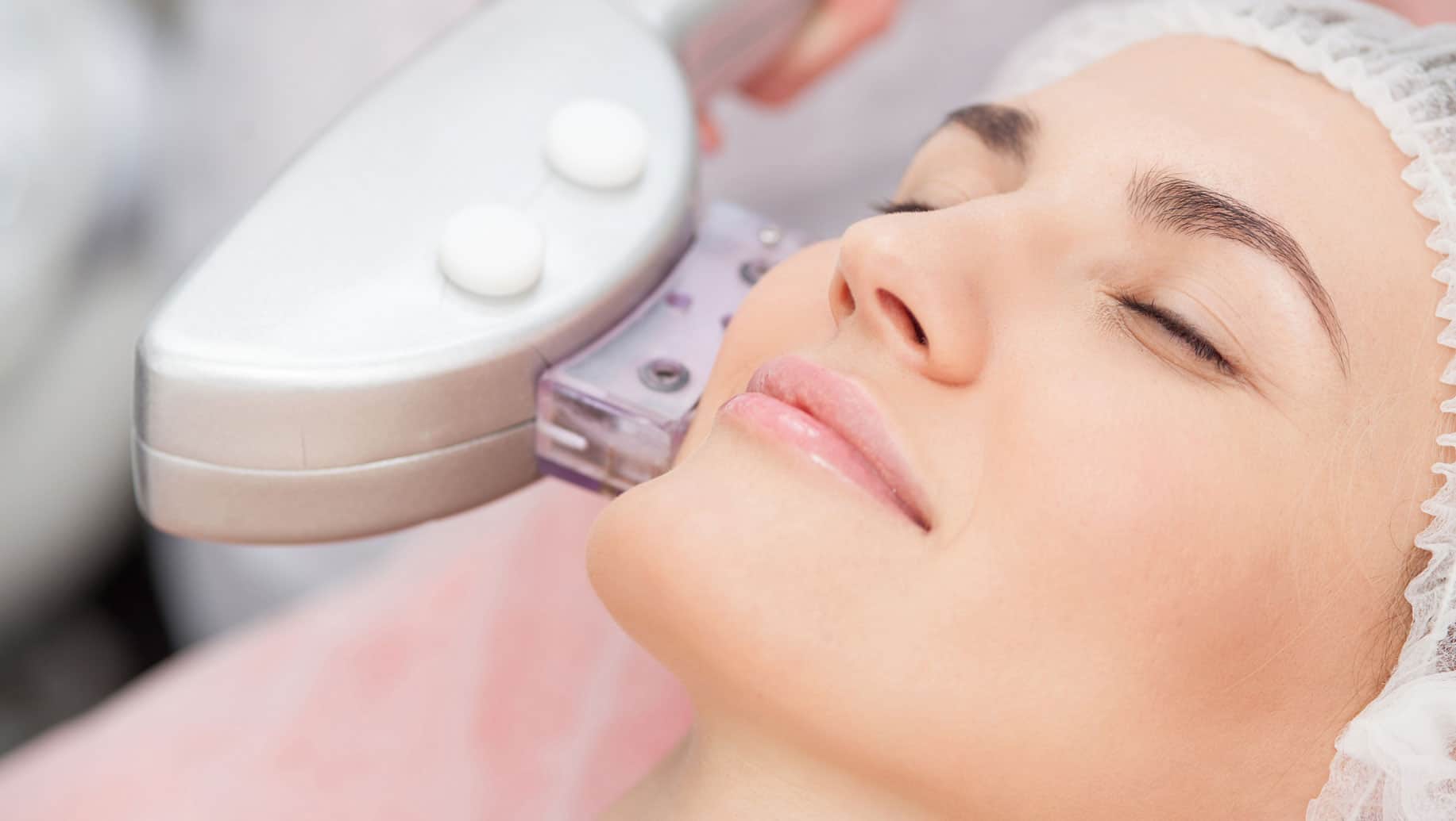 Laser Resurfacing