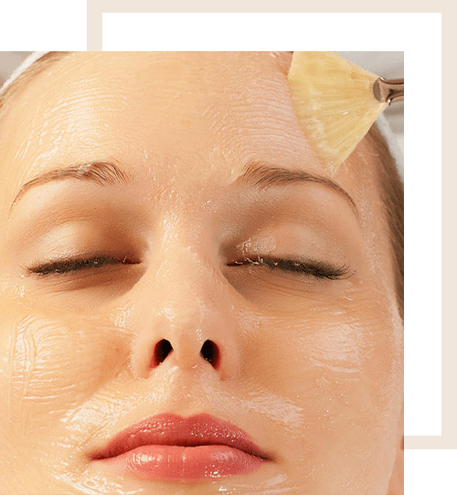 Chemical peels